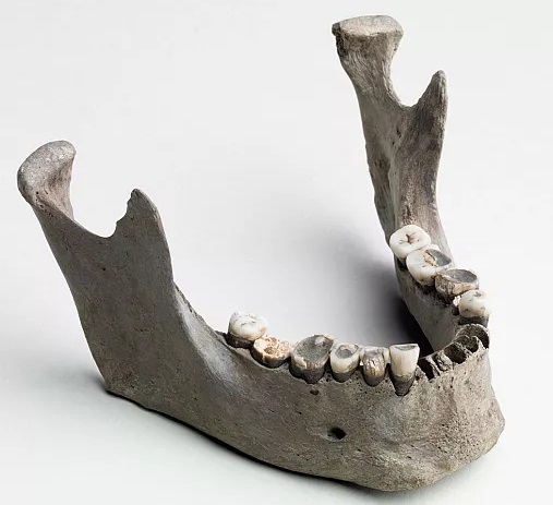 کشف اطلاعات جدید در مورد زندگی یک قربانی آیینی 5 هزار سال پیش در دانمارک