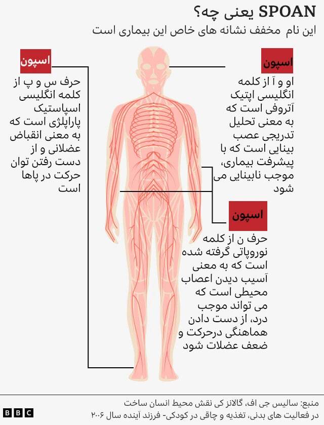 بیماری نادر در یک شهر دور افتاده که در آن 