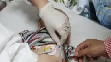 درخواست سختی کار برای تعرفه‌های پرستاری در حوزه کودکان