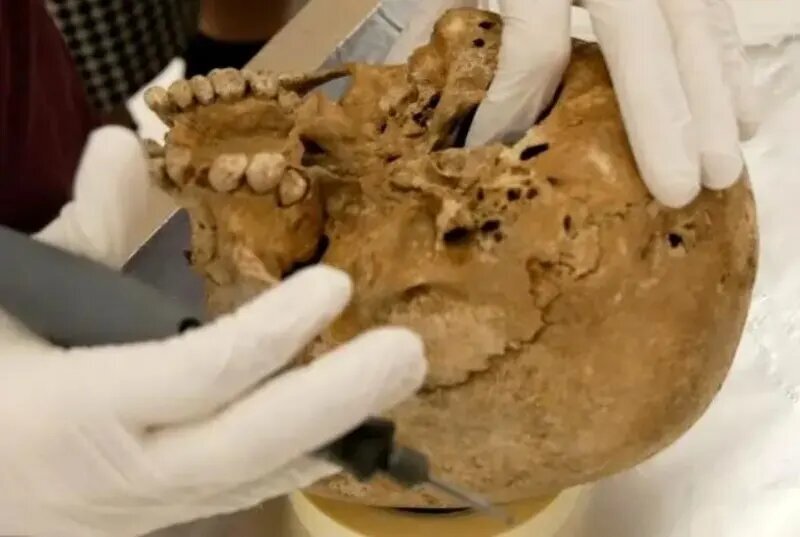 این اسکلت 12000 ساله دارای یک بیماری ژنتیکی نادر است! این اسکلت 12000 ساله دارای یک بیماری ژنتیکی نادر است!