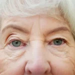 تغییر شکل قرنیه با جریان برق؛ روش آزمایشی جدید اصلاح نزدیک‌بینی بدون لیزیک