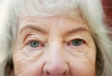 تغییر شکل قرنیه با جریان برق؛ روش آزمایشی جدید اصلاح نزدیک‌بینی بدون لیزیک